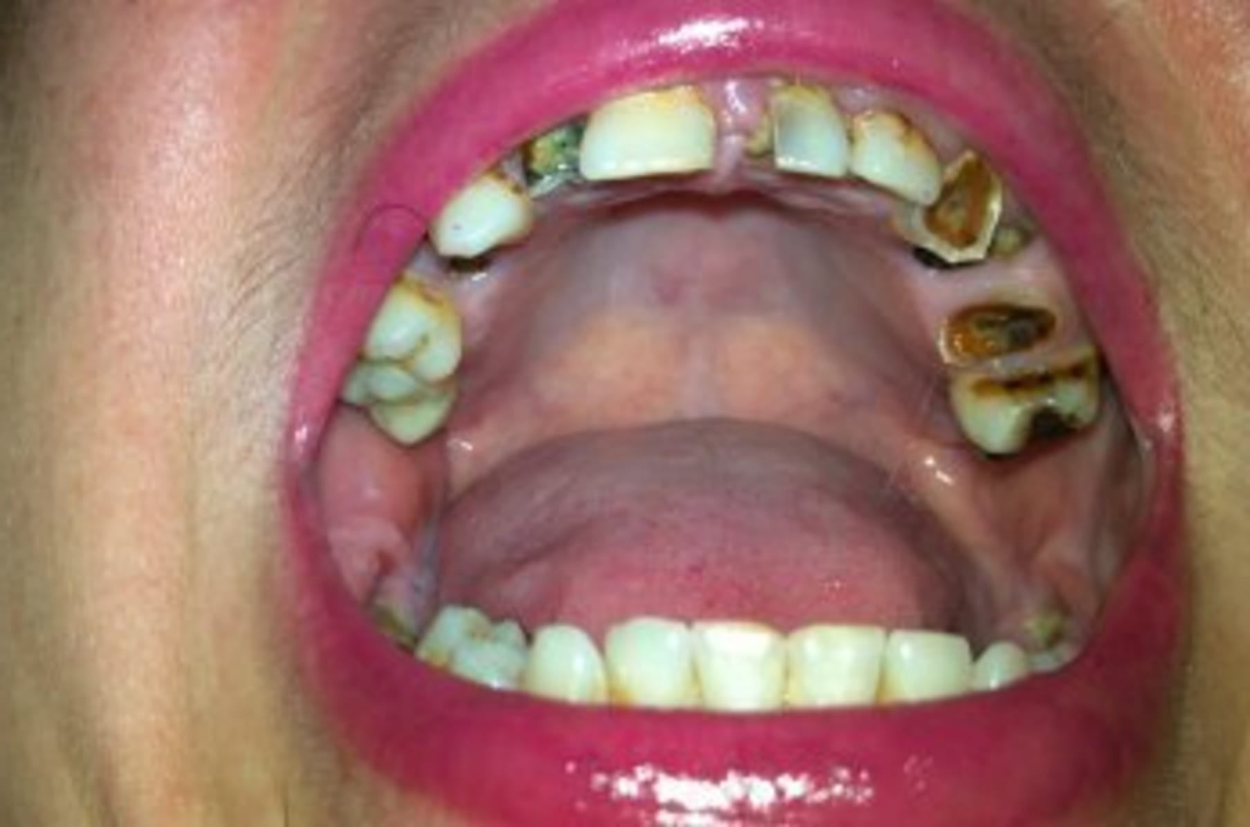 Please Help Me Fix My Teeth | Indiegogo