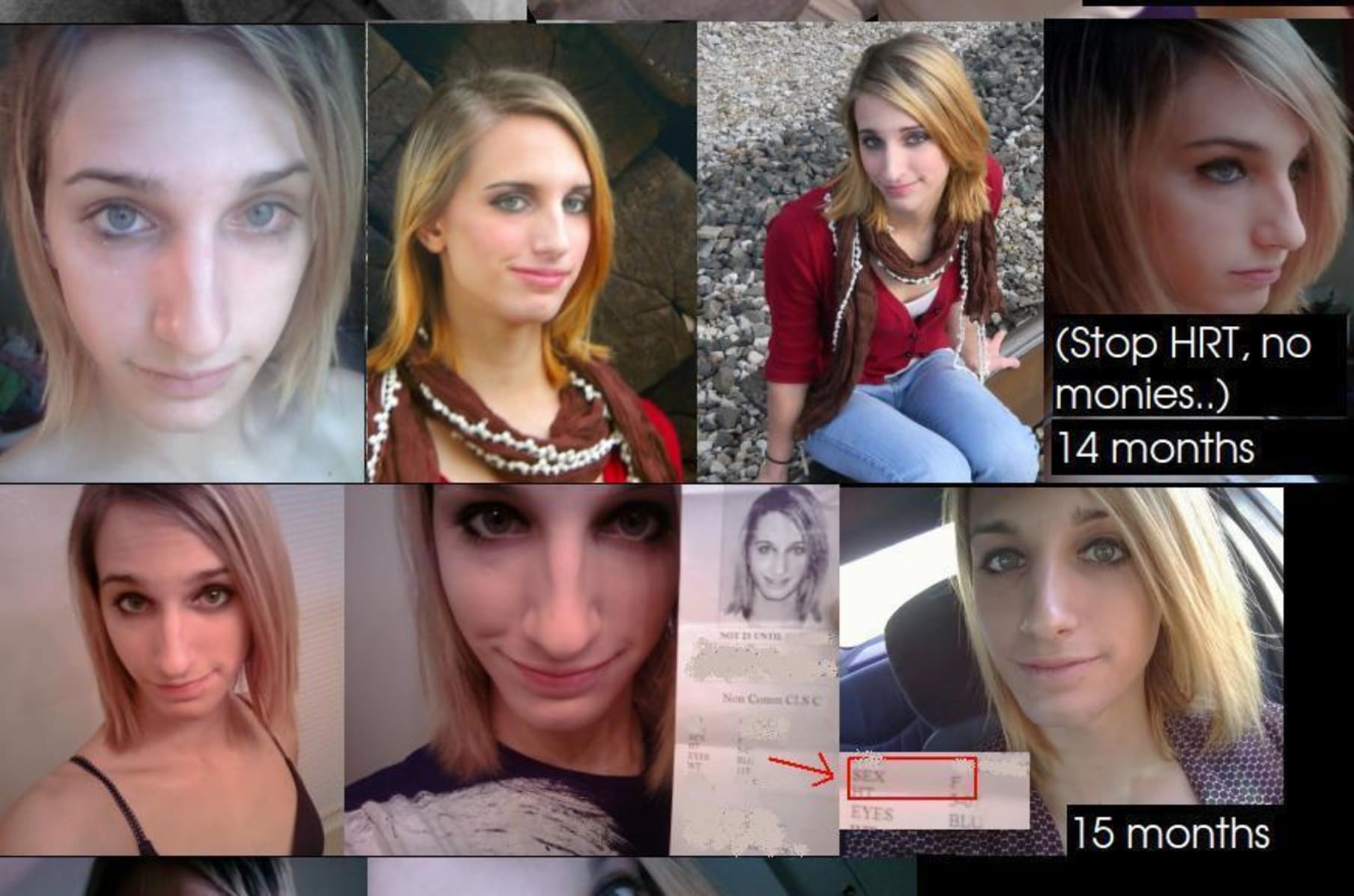 Kelly and Korra's Medical Surgeries | Indiegogo