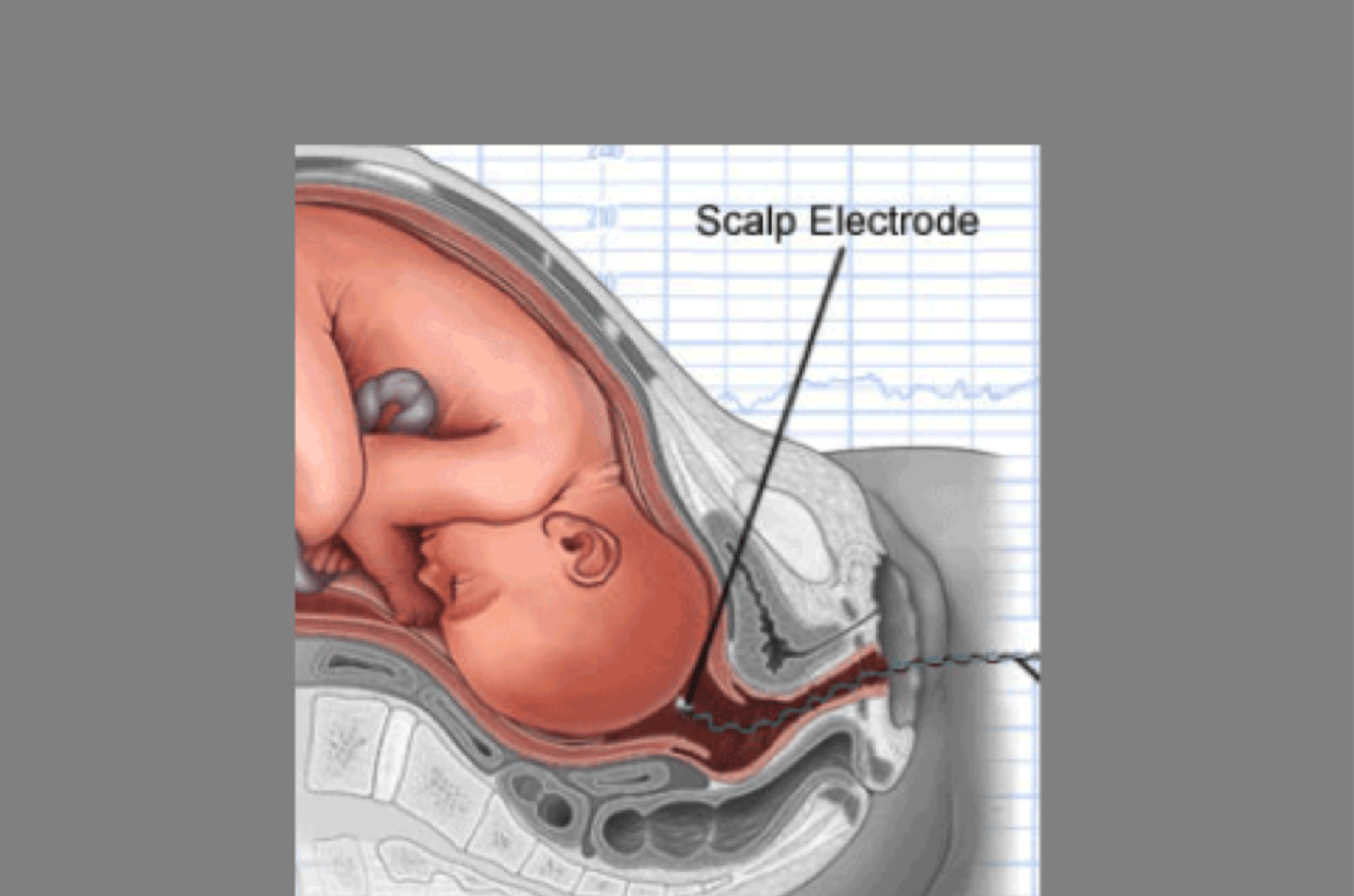 Heart rate monitor baby head 2025